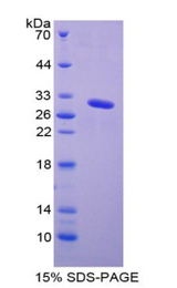 GLA / Alpha Galactosidase Protein - Recombinant Galactosidase Alpha By SDS-PAGE