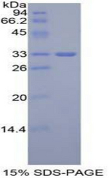GLI3 Protein - Recombinant GLI Family Zinc Finger Protein 3 By SDS-PAGE