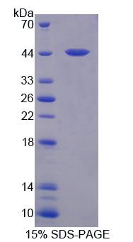 GLMP / C1orf85 Protein - Recombinant Glycosylated Lysosomal Membrane Protein By SDS-PAGE