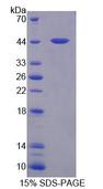 GLMP / C1orf85 Protein - Recombinant Glycosylated Lysosomal Membrane Protein By SDS-PAGE