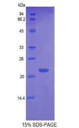 GLO1 / Glyoxalase I Protein - Recombinant Glyoxalase I By SDS-PAGE