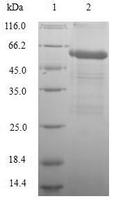 GLP1R / GLP-1 Receptor Protein - (Tris-Glycine gel) Discontinuous SDS-PAGE (reduced) with 5% enrichment gel and 15% separation gel.