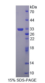 GLRX3 / Glutaredoxin 3 Protein - Recombinant  Glutaredoxin 3 By SDS-PAGE