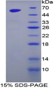 GOLM1 / GP73 / GOLPH2 Protein - Recombinant Golgi Protein 73 By SDS-PAGE