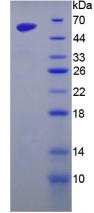 GOLM1 / GP73 / GOLPH2 Protein - Active Golgi Protein 73 (GP73) by SDS-PAGE