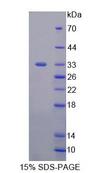 GP1BA / CD42b Protein - Recombinant  Glycoprotein Ib Alpha Polypeptide, Platelet By SDS-PAGE