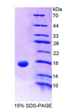 GP1BB / CD42c Protein - Recombinant  Glycoprotein Ib Beta Polypeptide, Platelet By SDS-PAGE