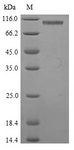 GP2 Protein - (Tris-Glycine gel) Discontinuous SDS-PAGE (reduced) with 5% enrichment gel and 15% separation gel.