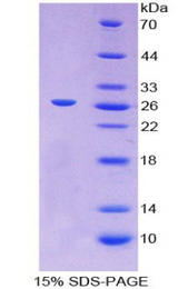 GP2 Protein - Recombinant Glycoprotein 2, Zymogen Granule Membrane By SDS-PAGE