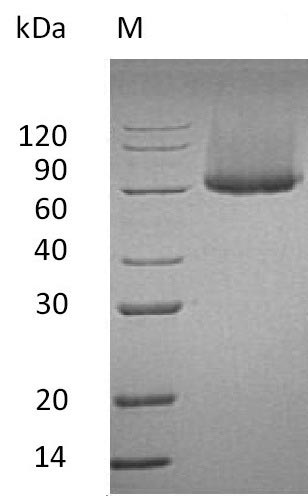 GPC1 / Glypican Protein - (Tris-Glycine gel) Discontinuous SDS-PAGE (reduced) with 5% enrichment gel and 15% separation gel.