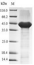 GPC4 / Glypican 4 Protein - (Tris-Glycine gel) Discontinuous SDS-PAGE (reduced) with 5% enrichment gel and 15% separation gel.