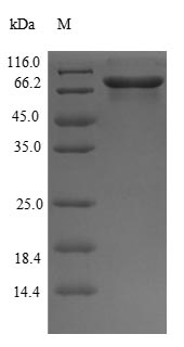 GPI Protein - (Tris-Glycine gel) Discontinuous SDS-PAGE (reduced) with 5% enrichment gel and 15% separation gel.