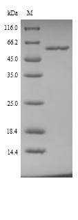GPT / Alanine Transaminase Protein - (Tris-Glycine gel) Discontinuous SDS-PAGE (reduced) with 5% enrichment gel and 15% separation gel.