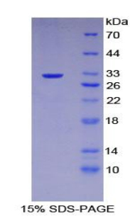 GPV / CD42d Protein - Recombinant Glycoprotein V, Platelet By SDS-PAGE
