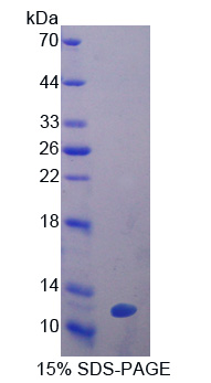 GPX3 Protein - Recombinant  Glutathione Peroxidase 3, Plasma By SDS-PAGE