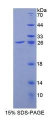 GPX6 / GPX-6 Protein - Recombinant Glutathione Peroxidase 6, Olfactory (GPX6) by SDS-PAGE