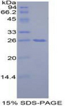 GRB7 Protein - Recombinant Growth Factor Receptor Bound Protein 7 By SDS-PAGE