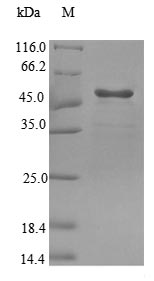 GRHPR / Glyoxylate Reductase Protein - (Tris-Glycine gel) Discontinuous SDS-PAGE (reduced) with 5% enrichment gel and 15% separation gel.