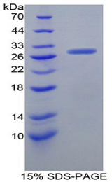 GRN / Granulin Protein - Recombinant Granulin By SDS-PAGE