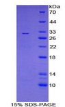 Growth Hormone Receptor / GHR Protein - Recombinant Growth Hormone Receptor By SDS-PAGE