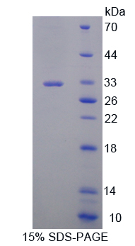GSR / Glutathione Reductase Protein - Recombinant  Glutathione Reductase By SDS-PAGE