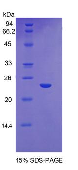 GSS / Glutathione Synthetase Protein - Recombinant Glutathione Synthetase By SDS-PAGE