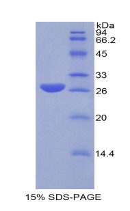 GSTA1 Protein - Recombinant Glutathione S Transferase Alpha 1 By SDS-PAGE