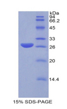 GSTA1 Protein - Recombinant Glutathione S Transferase Alpha 1 By SDS-PAGE