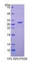 GSTA2 Protein - Recombinant  Glutathione S Transferase Alpha 2 By SDS-PAGE