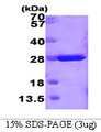 GSTM1 Protein