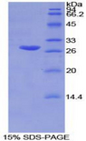GSTM2 Protein - Recombinant Glutathione S Transferase Mu 2, Muscle By SDS-PAGE