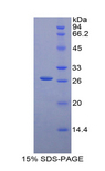 GUSB / Beta Glucuronidase Protein - Recombinant Glucuronidase Beta By SDS-PAGE