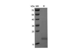 GZMM / Granzyme M Protein - Recombinant Mouse DNMT1 Protein (His Tag)-Elabscience