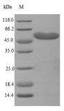 HADHB Protein - (Tris-Glycine gel) Discontinuous SDS-PAGE (reduced) with 5% enrichment gel and 15% separation gel.