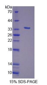 HADHB Protein - Recombinant  Hydroxyacyl Coenzyme A Dehydrogenase Beta By SDS-PAGE