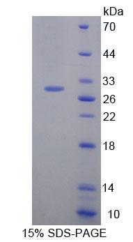 HAND1 Protein - Recombinant Heart And Neural Crest Derivatives Expressed Protein 1 By SDS-PAGE