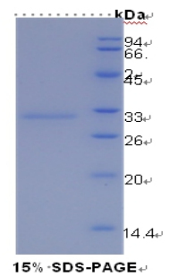 HAVCR1 / KIM-1 Protein - Recombinant Kidney Injury Molecule 1 By SDS-PAGE
