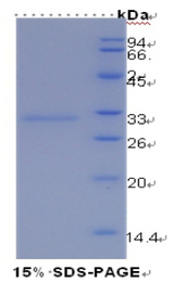 HAVCR1 / KIM-1 Protein - Recombinant Kidney Injury Molecule 1 By SDS-PAGE
