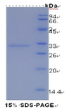 HAVCR1 / KIM-1 Protein - Recombinant Kidney Injury Molecule 1 By SDS-PAGE