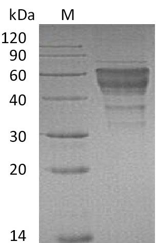 HAVCR2 / TIM-3 Protein - (Tris-Glycine gel) Discontinuous SDS-PAGE (reduced) with 5% enrichment gel and 15% separation gel.