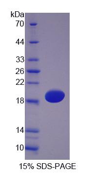 HBA1 Protein - Recombinant  Hemoglobin Alpha 1 By SDS-PAGE