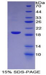HBEGF / HB EGF Protein - Recombinant Heparin Binding Epidermal Growth Factor Like Growth Factor By SDS-PAGE