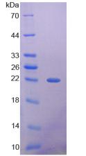 HDAC4 Protein - Recombinant Histone Deacetylase 4 By SDS-PAGE