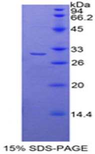 HDAC6 Protein - Recombinant Histone Deacetylase 6 By SDS-PAGE