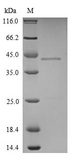 HDGF Protein - (Tris-Glycine gel) Discontinuous SDS-PAGE (reduced) with 5% enrichment gel and 15% separation gel.