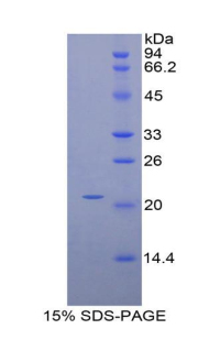 HDGF Protein - Recombinant Hepatoma Derived Growth Factor By SDS-PAGE