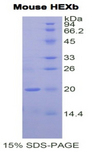 HEXB Protein - Recombinant Hexosaminidase B Beta By SDS-PAGE