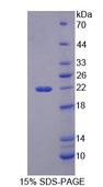 HIBCH Protein - Recombinant 3-Hydroxyisobutyryl Coenzyme A Hydrolase (HIBCH) by SDS-PAGE