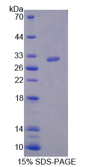 HLA-DRB1 Protein - Recombinant Major Histocompatibility Complex Class II DR Beta 1 By SDS-PAGE