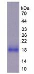 HMCN1 Protein - Recombinant Hemicentin 1 By SDS-PAGE